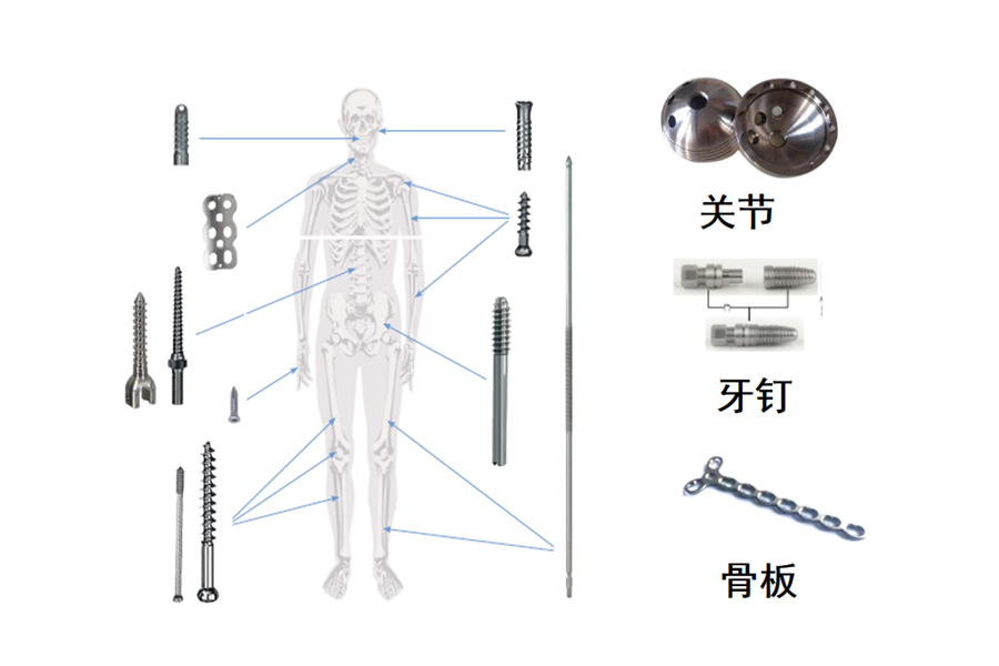 醫(yī)療骨科、牙釘、脊椎
